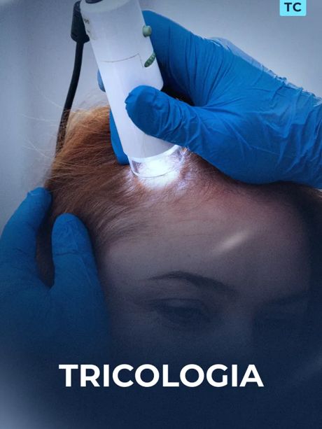Tricologia